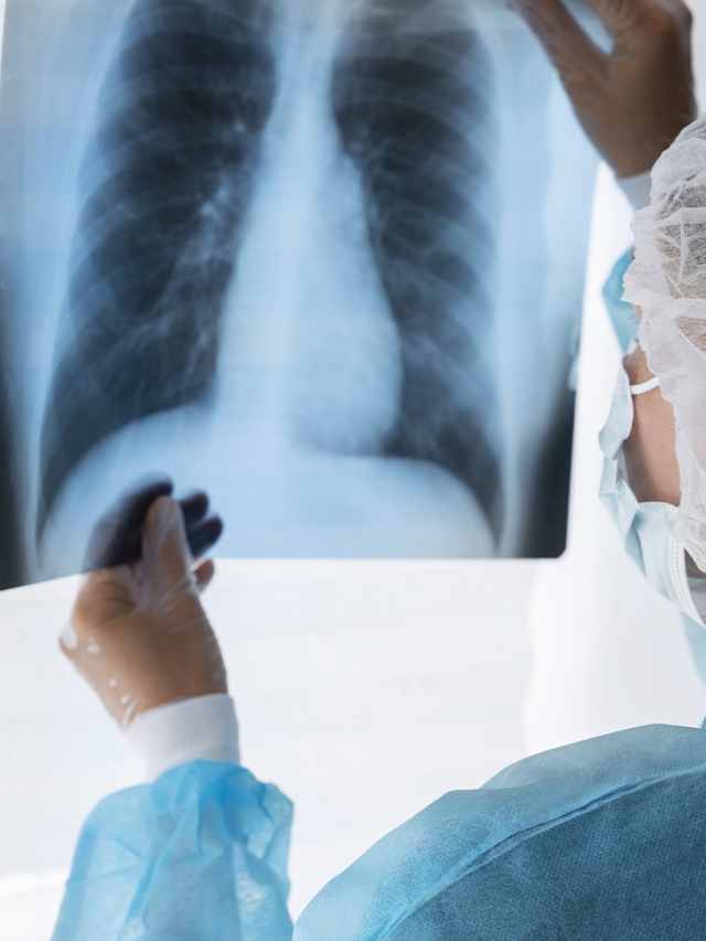 Radiologia: O Que é, Como Funciona e Por Que é Essencial