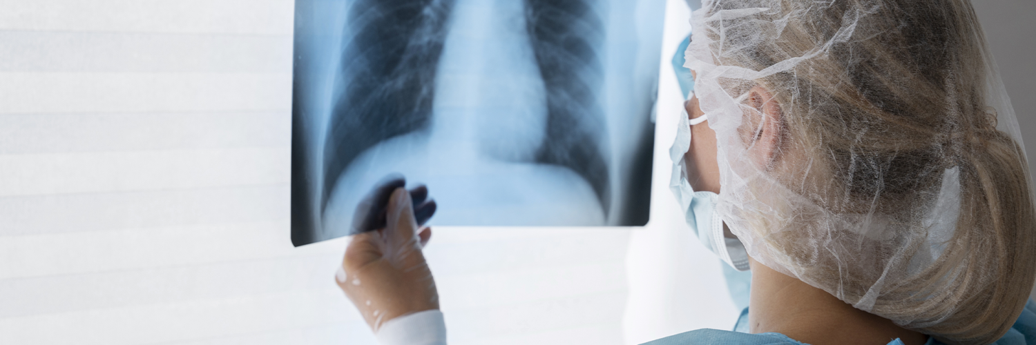 Profissional de saúde analisa radiografia de tórax, vestindo máscara, touca e avental de proteção.
