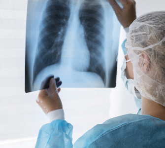 Profissional de saúde analisa radiografia de tórax, vestindo máscara, touca e avental de proteção.