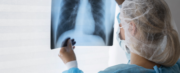 Profissional de saúde analisa radiografia de tórax, vestindo máscara, touca e avental de proteção.