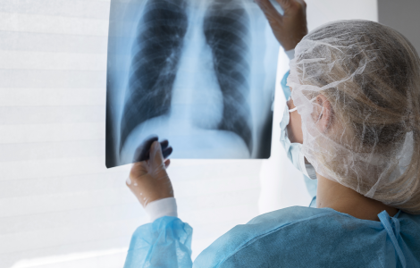 Profissional de saúde analisa radiografia de tórax, vestindo máscara, touca e avental de proteção.