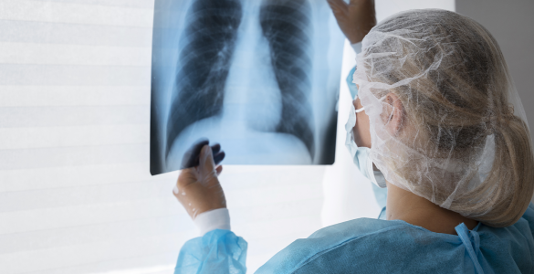 Profissional de saúde analisa radiografia de tórax, vestindo máscara, touca e avental de proteção.