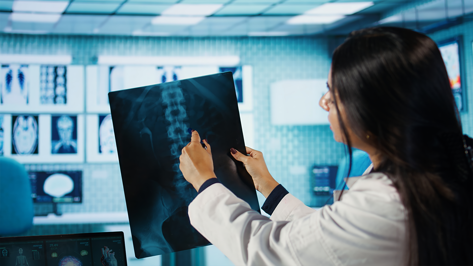 Médica analisa radiografia da coluna lombar em sala de exames, apontando área específica na imagem.