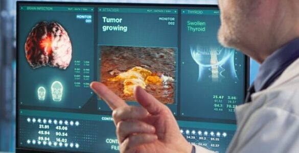 Physician and patient discuss x ray and MRI scan focusing on preventive medicine